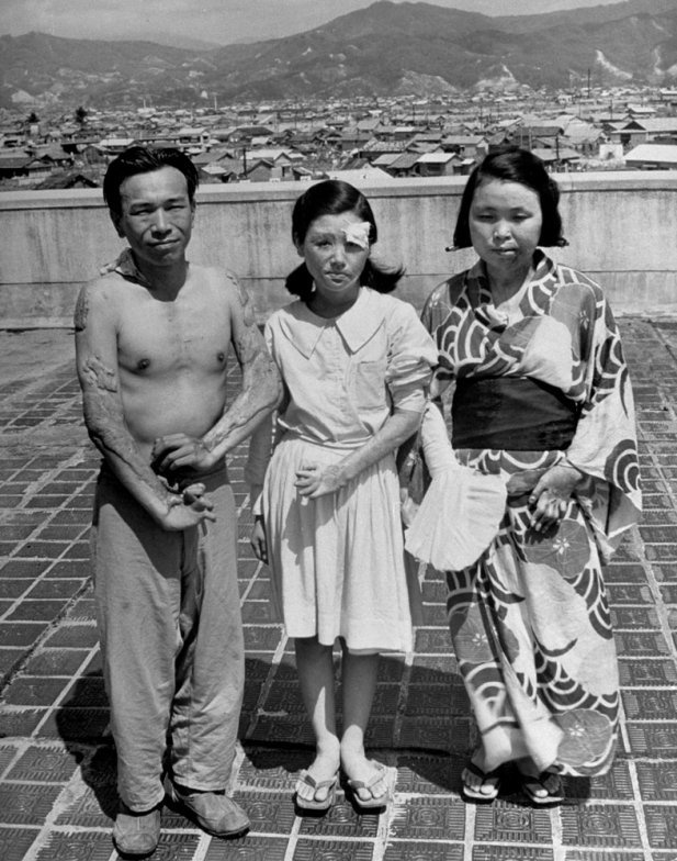 The aftermath of the US atomic bomb explosions in Japan