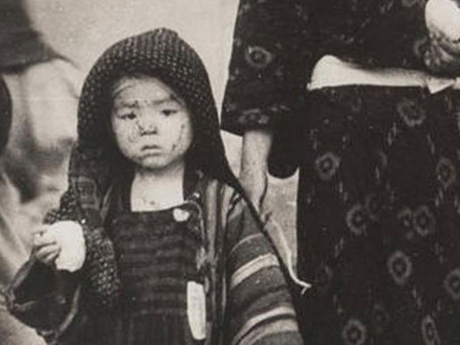 The aftermath of the US atomic bomb explosions in Japan